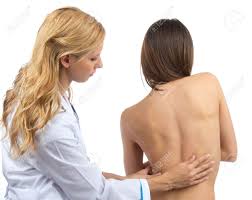 la scoliosi ; prevenzione e trattamento